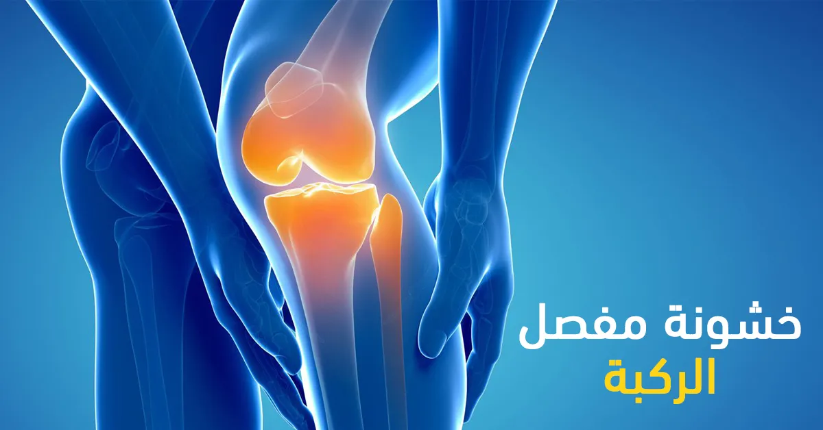 خشونة مفصل الركبة